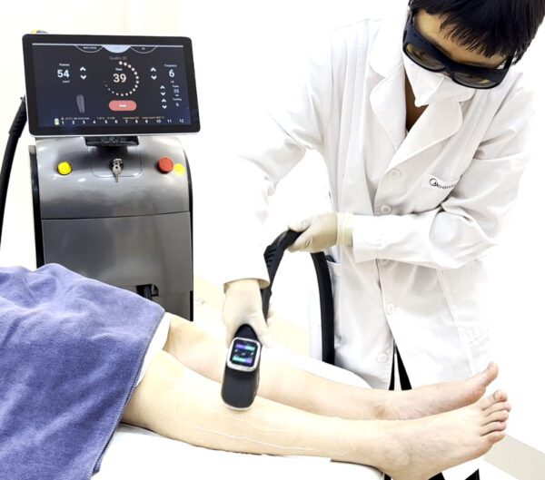 AI Laser Hair Removal Machine