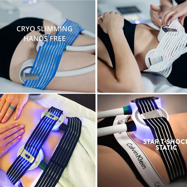 cryoskin machine for sale