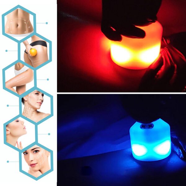 Cryoskin Machine