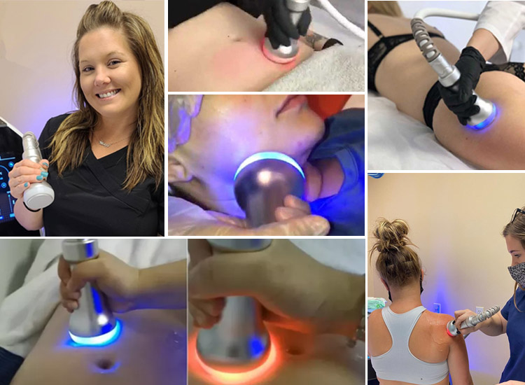 Cryoskin Machine handle