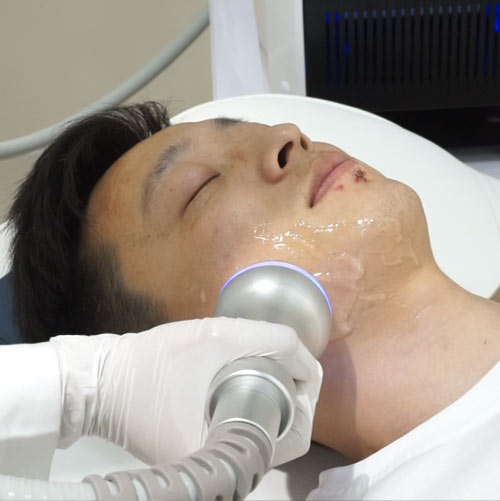 face slimming machine