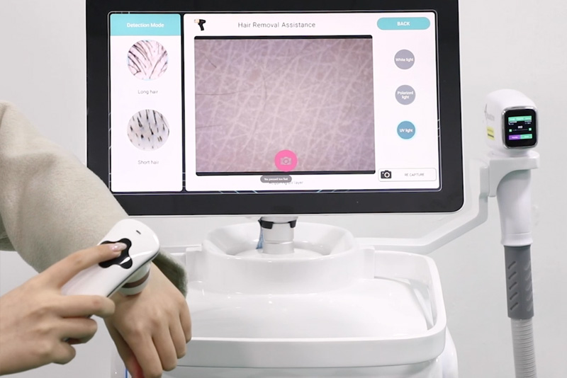 oem laser hair removal machine