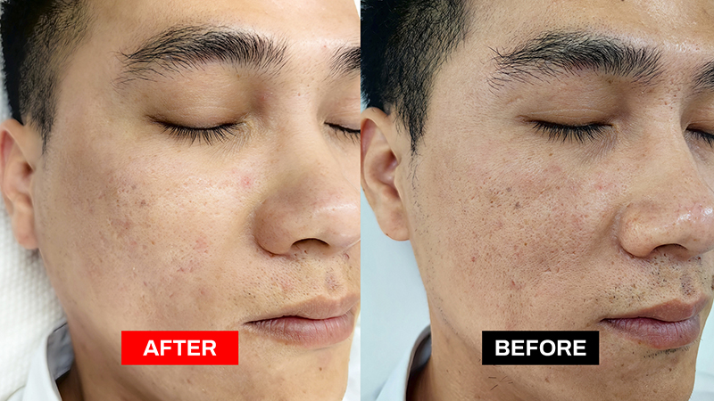 crystallite before and after