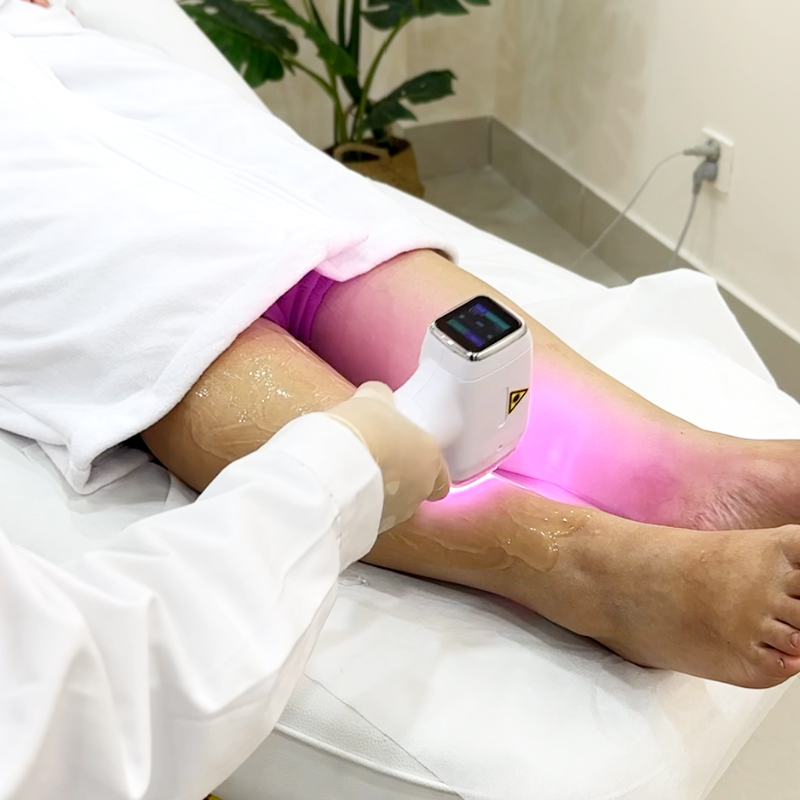 laser hair removal machine supplier