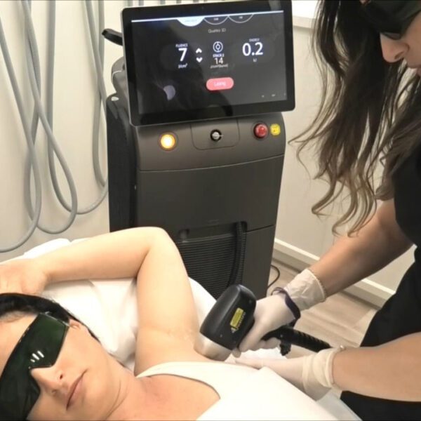 Cooperation case of diode laser hair removal machine