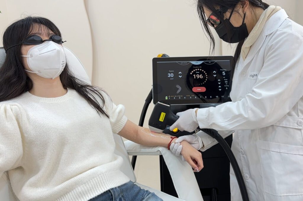 laser hair removal machine