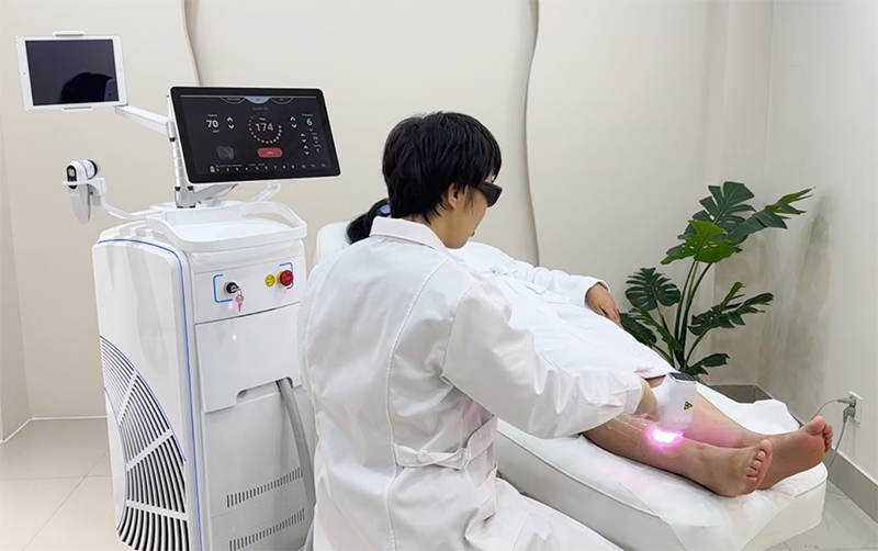 diode laser hair removal machines