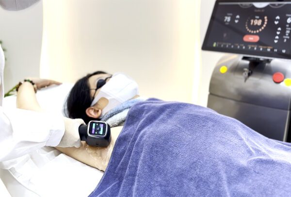 laser hiar removal