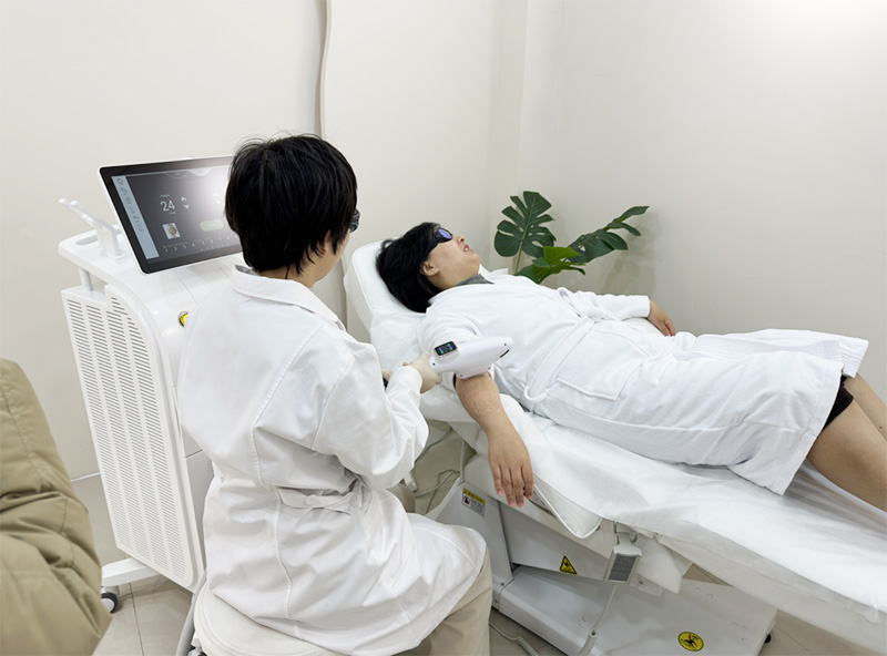 IPL laser hair removal machines
