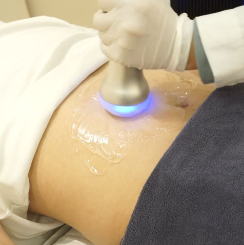 Cryoskin therapy