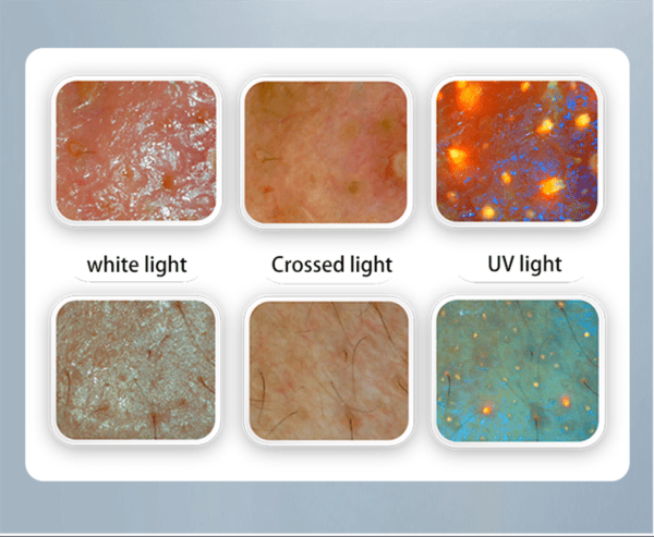 skin care analyzer​
