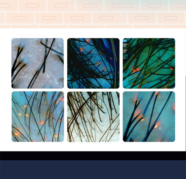 hair analyzer