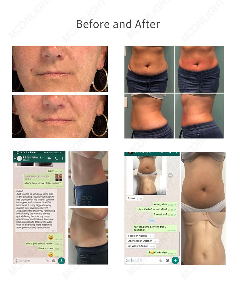 Cryoskin Reviews