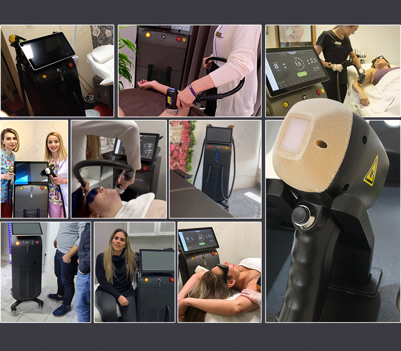 Best Rated Laser Hair Removal