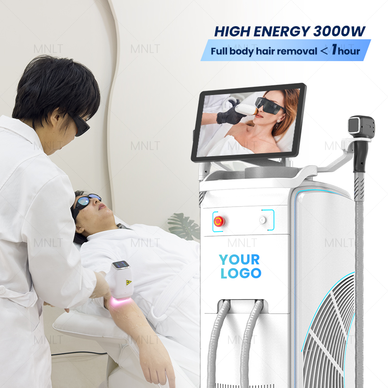 Should I Buy a Laser Hair Removal Machine
