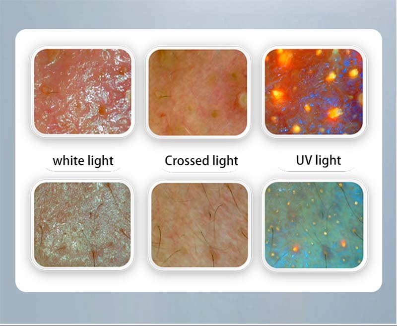 Skin and hair condition detection