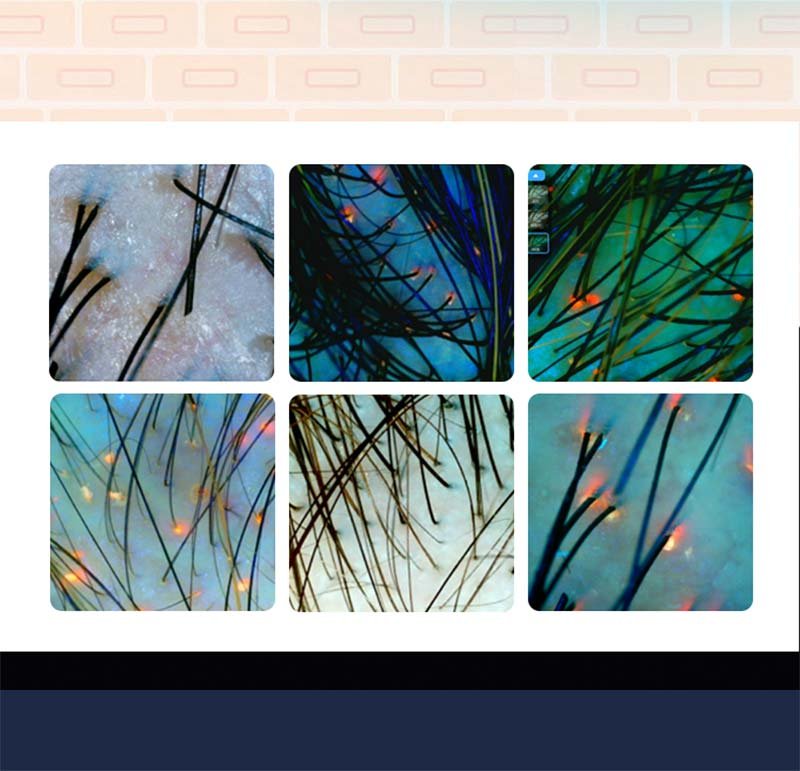 Skin and hair condition detection