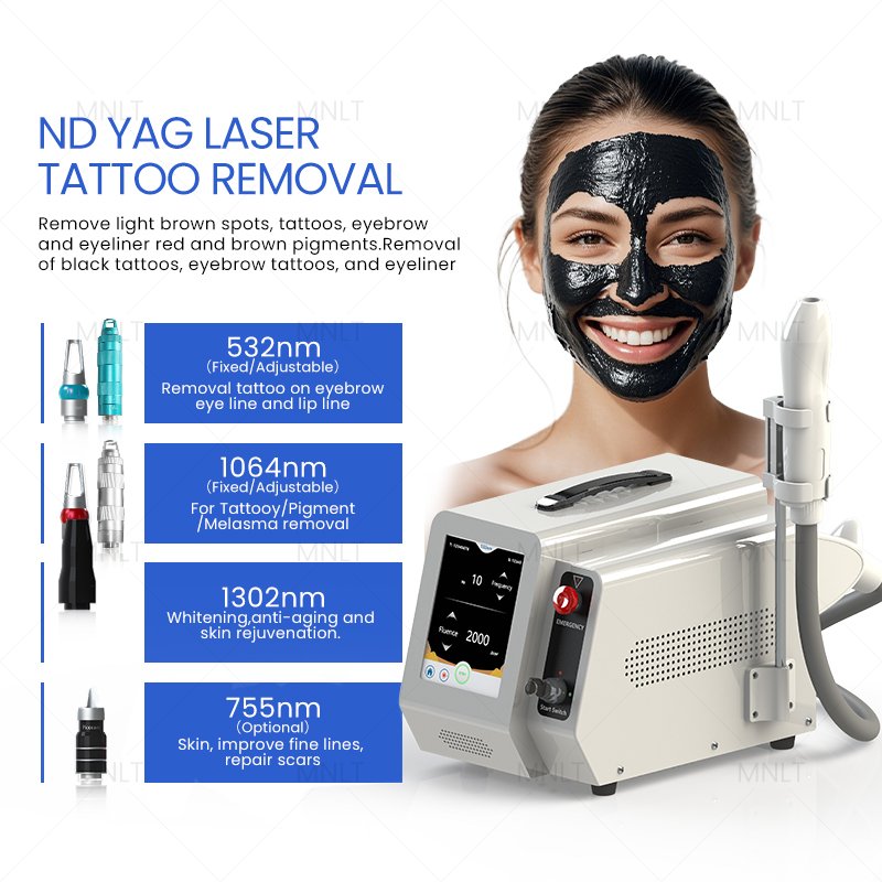 ND YAG laser tattoo removal machines