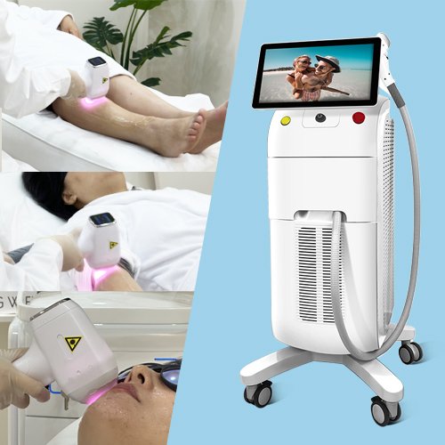 Best Professional Laser Hair Removal Machine for Salon Owners