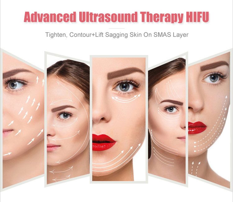 hifu treatment for face